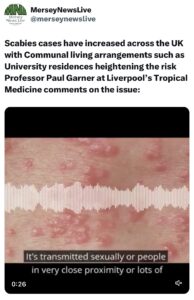 Scabies story twitter post link